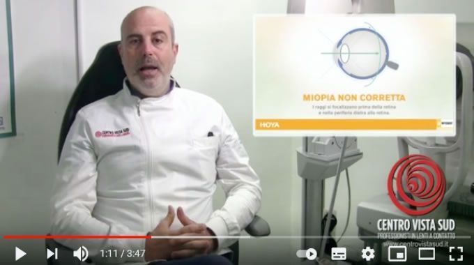 Hoya MiyoSmart, le lenti che gestiscono la progressione della miopia