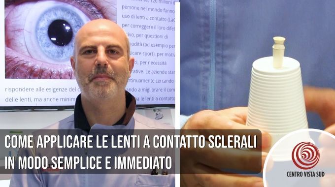 Come applicare le lenti a contatto sclerali in modo semplice e immediato