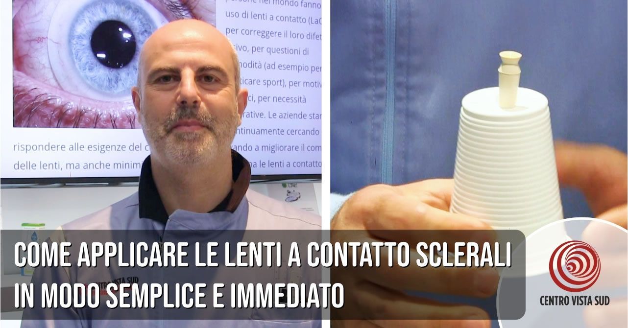 Come applicare le lenti a contatto sclerali in modo semplice e immediato